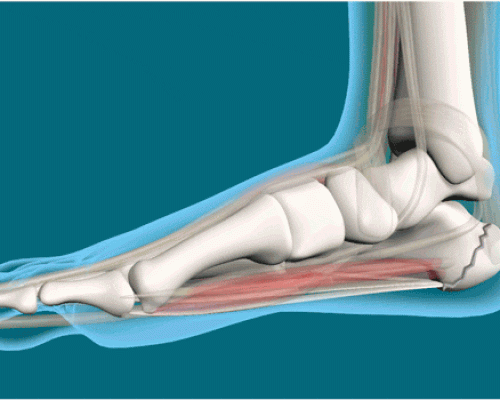 ORTHOPAEDICS